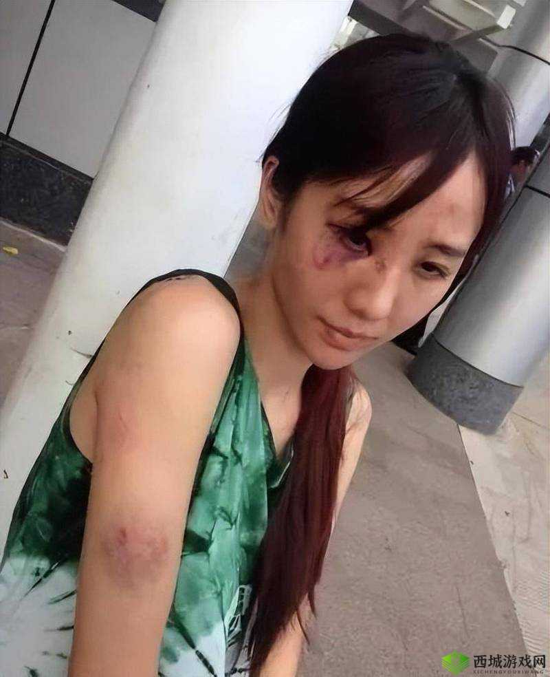 缅北女孩撕心裂肺:背后的故事与挣扎令人痛心