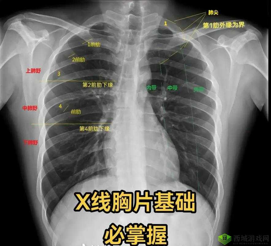 十大曝光胸片平台:揭示医疗影像背后的真相与警示